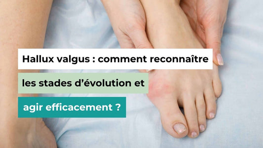 Hallux valgus : comment reconnaître les stades d’évolution et agir efficacement ? - Semello.fr