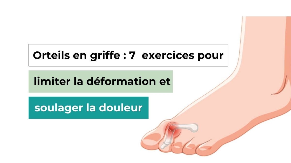 Orteils en griffe exercices 7 meilleurs pour limiter la déformation — free download