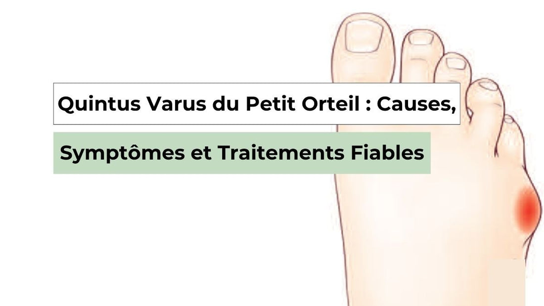 Quintus Varus du Petit Orteil : Causes, Symptômes et Traitements Fiables - Semello.fr