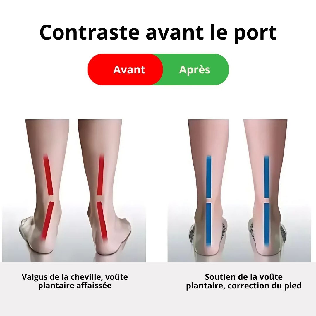 Sangle de Soutien pour Fasciite et Pieds Fatigués