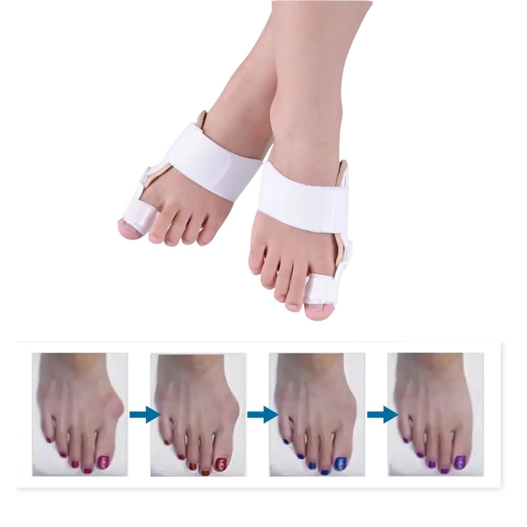Attelle amovible de nuit pour Hallux Valgus - Semello.fr