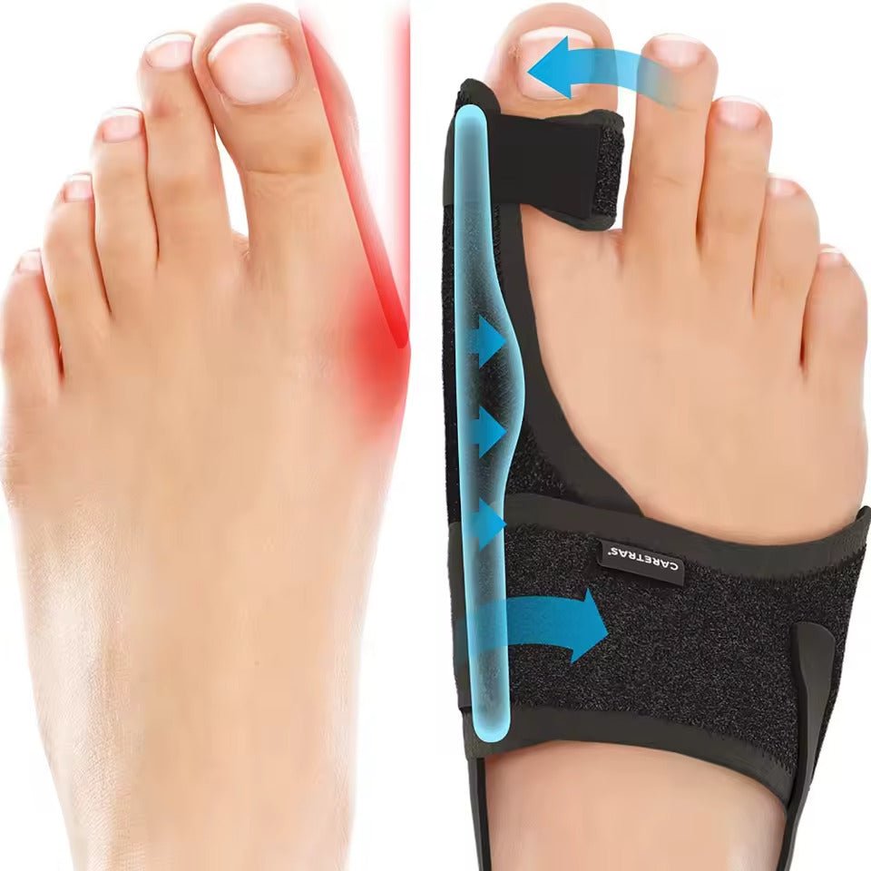 Attelle de nuit pour Hallux Valgus - Semello.fr