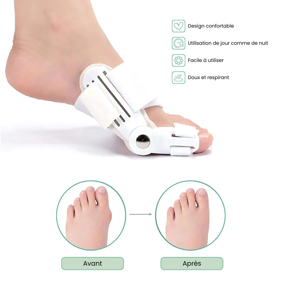 Attelle pour Hallux Valgus | Soulagement Nocturne Discret - Semello.fr