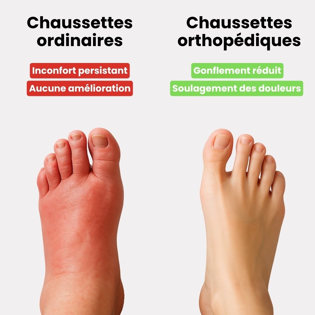Chaussettes de Compression Thérapeutiques - Semello.fr