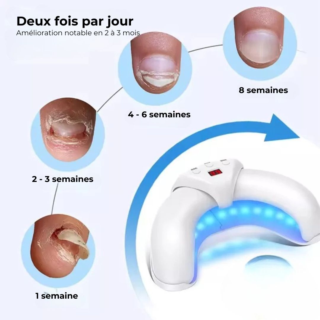 Dispositif de Traitement des Mycoses aux Ongles - Semello.fr
