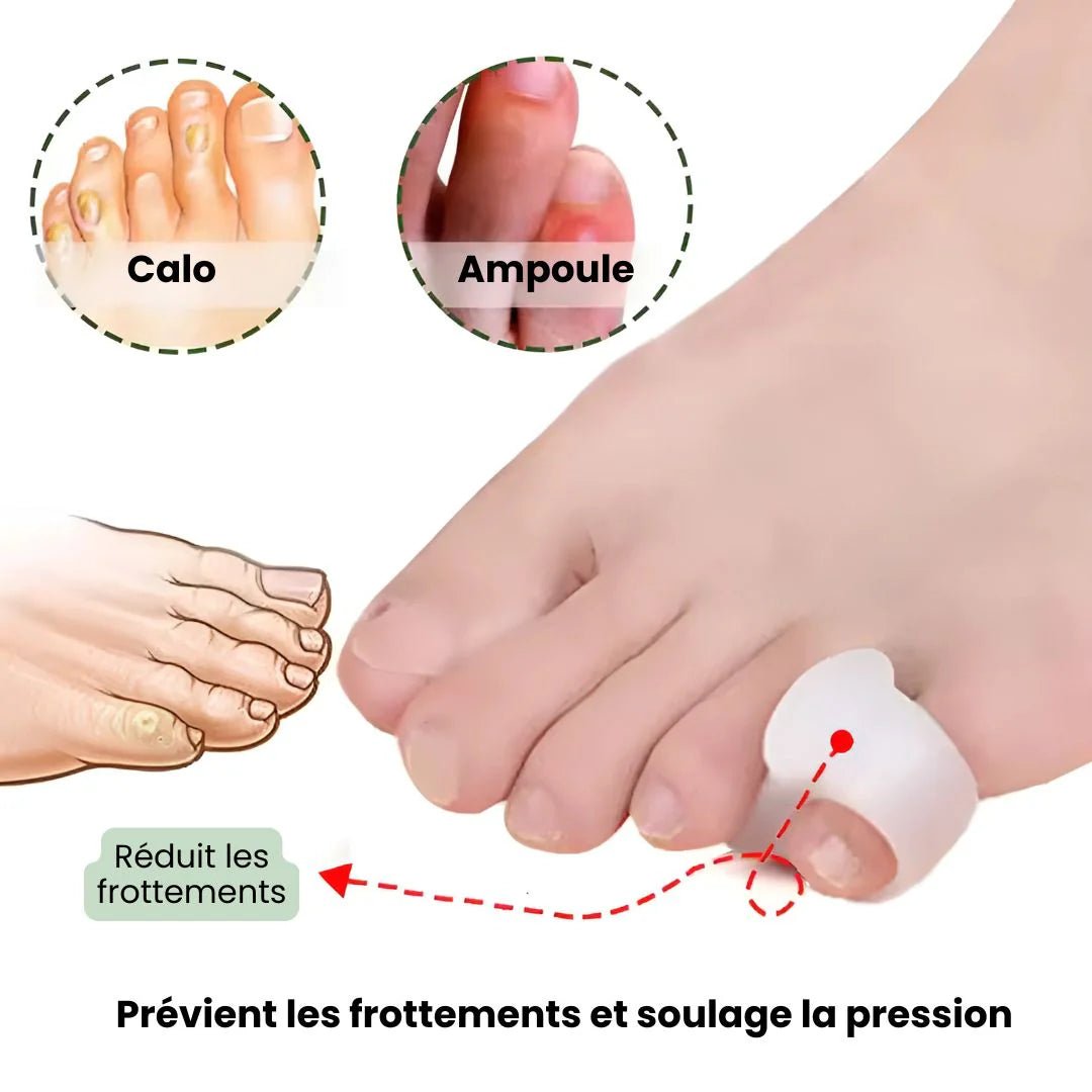 Orthèse pour Orteil en Griffe - Semello.fr