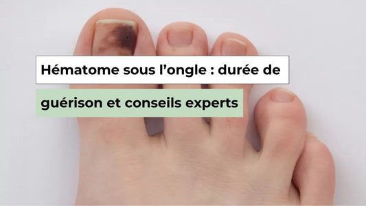 Hématome sous l’ongle : durée de guérison et conseils experts