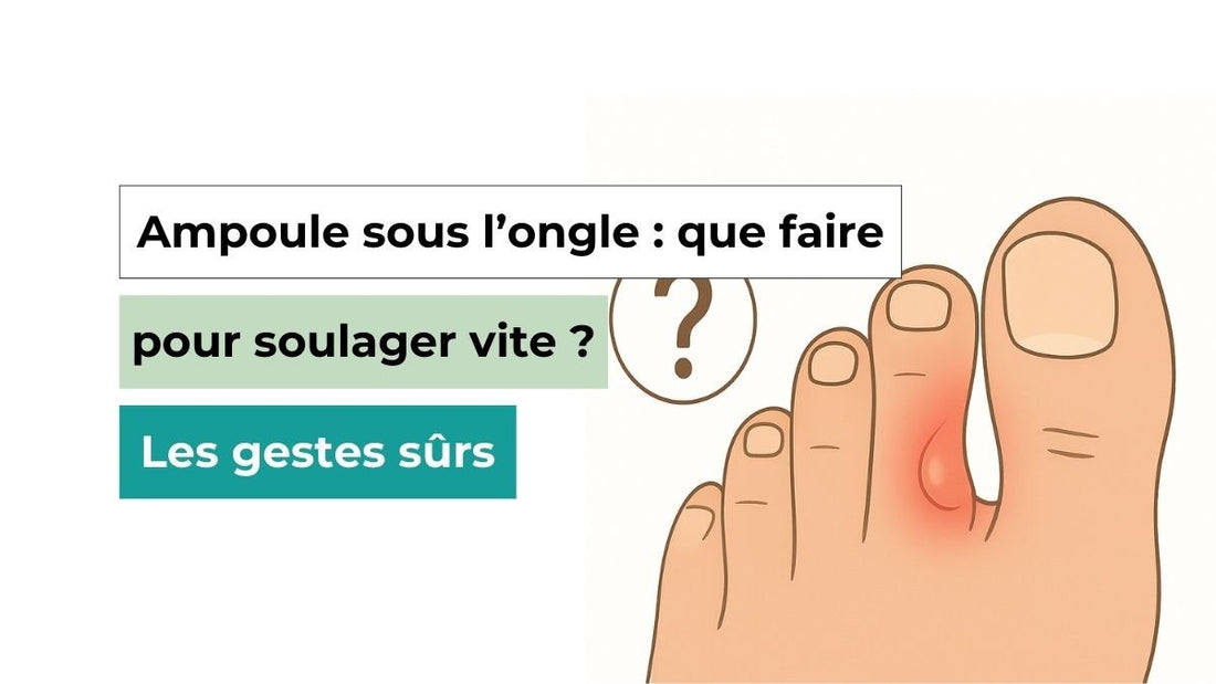 Ampoule sous l’ongle : que faire pour soulager vite ? Les gestes sûrs - Semello.fr