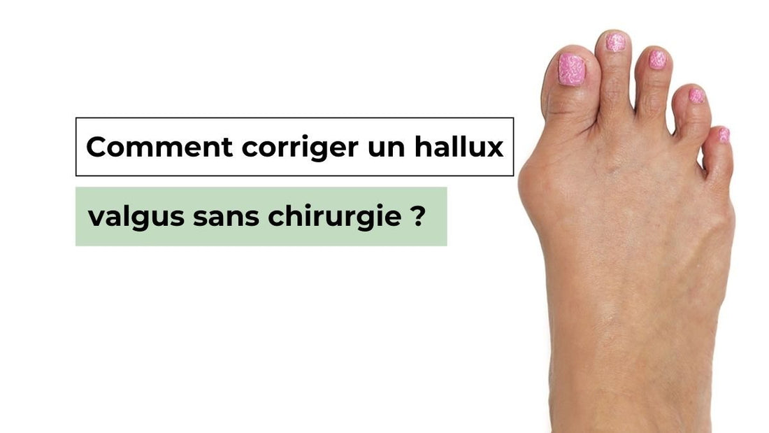 Comment corriger un hallux valgus sans chirurgie ? - Semello.fr