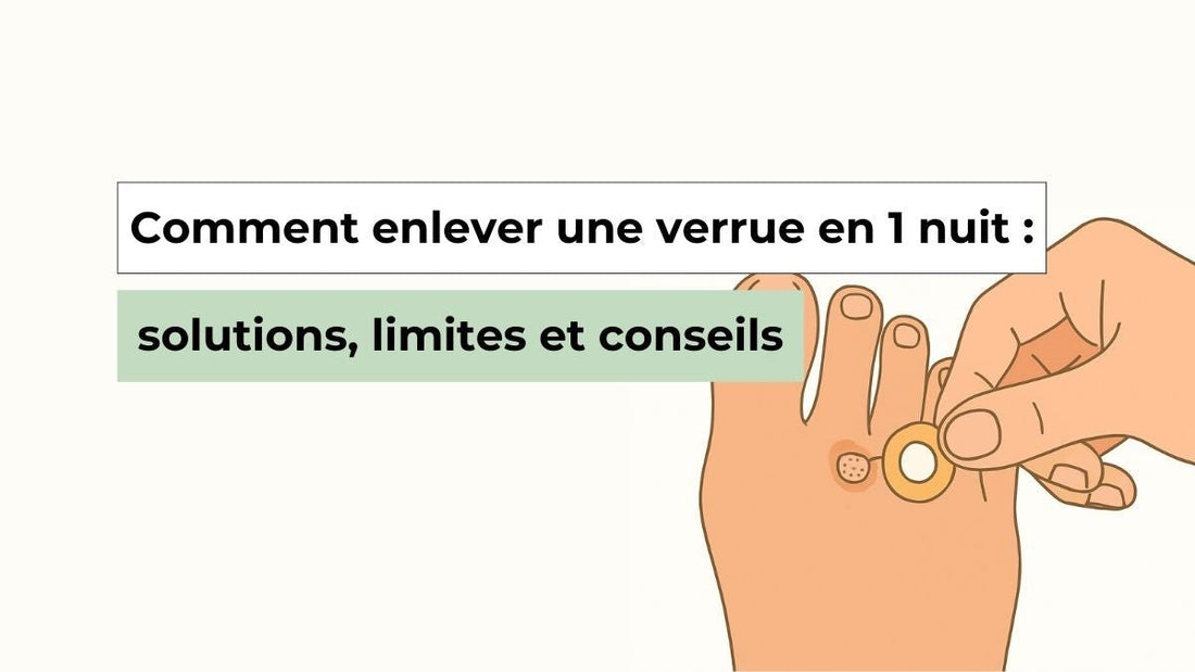Comment enlever une verrue en 1 nuit : solutions, limites et conseils - Semello.fr
