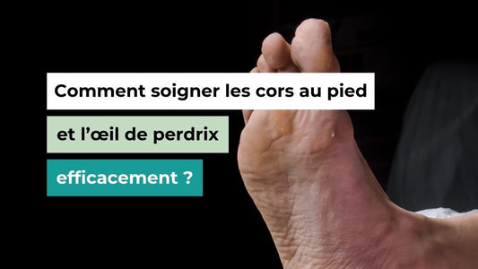 Comment soigner les cors au pied et l’œil de perdrix efficacement ? - Semello.fr