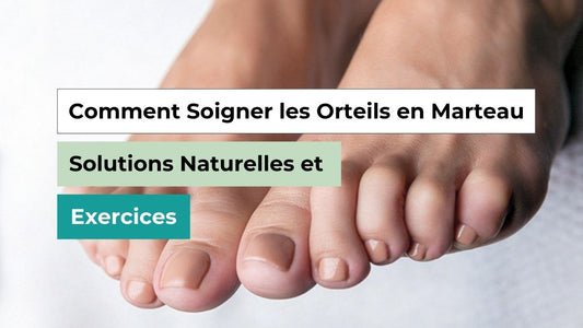 Comment Soigner les Orteils en Marteau : Solutions Naturelles et Exercices - Semello.fr