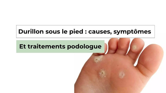 Comment soulager efficacement un durillon sous le pied : conseils d’experts - Semello.fr