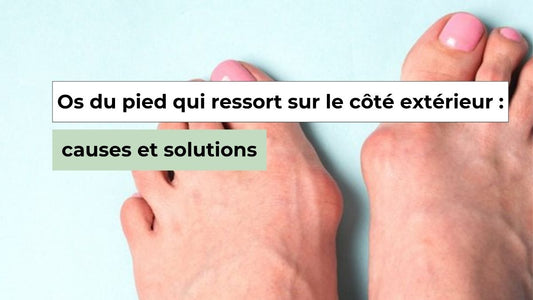 Comment soulager et prévenir un os du pied qui ressort sur le côté extérieur ? - Semello.fr