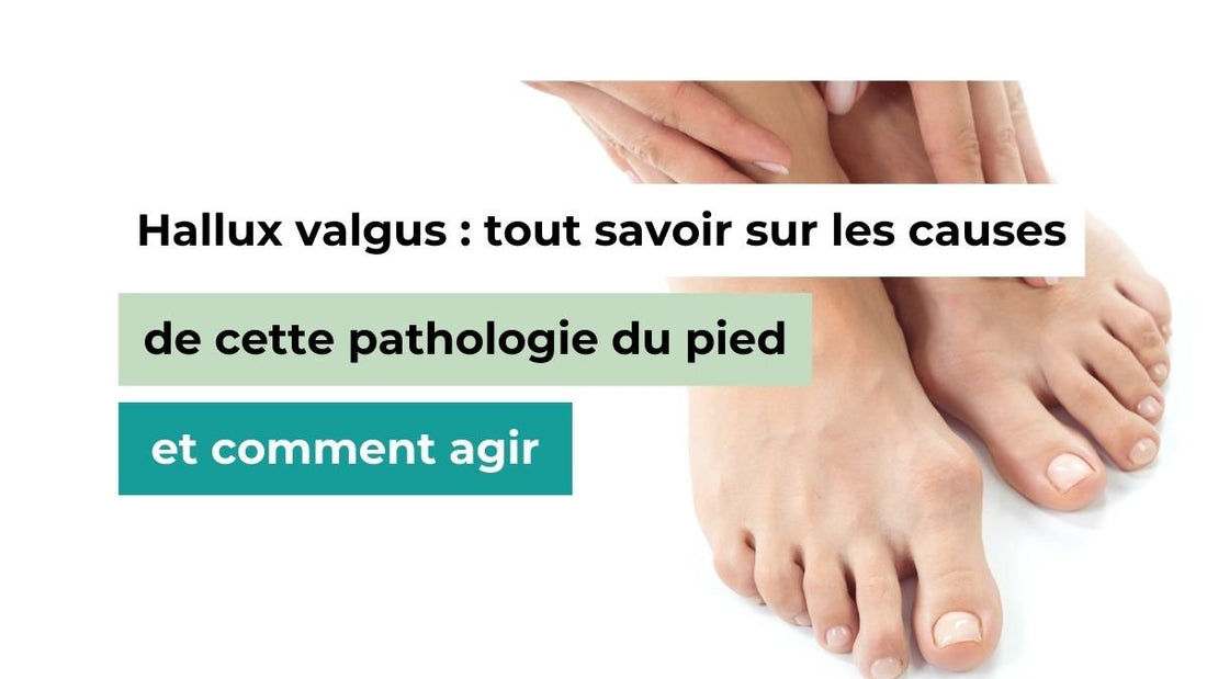 Hallux valgus : tout savoir sur les causes de cette pathologie du pied et comment agir - Semello.fr