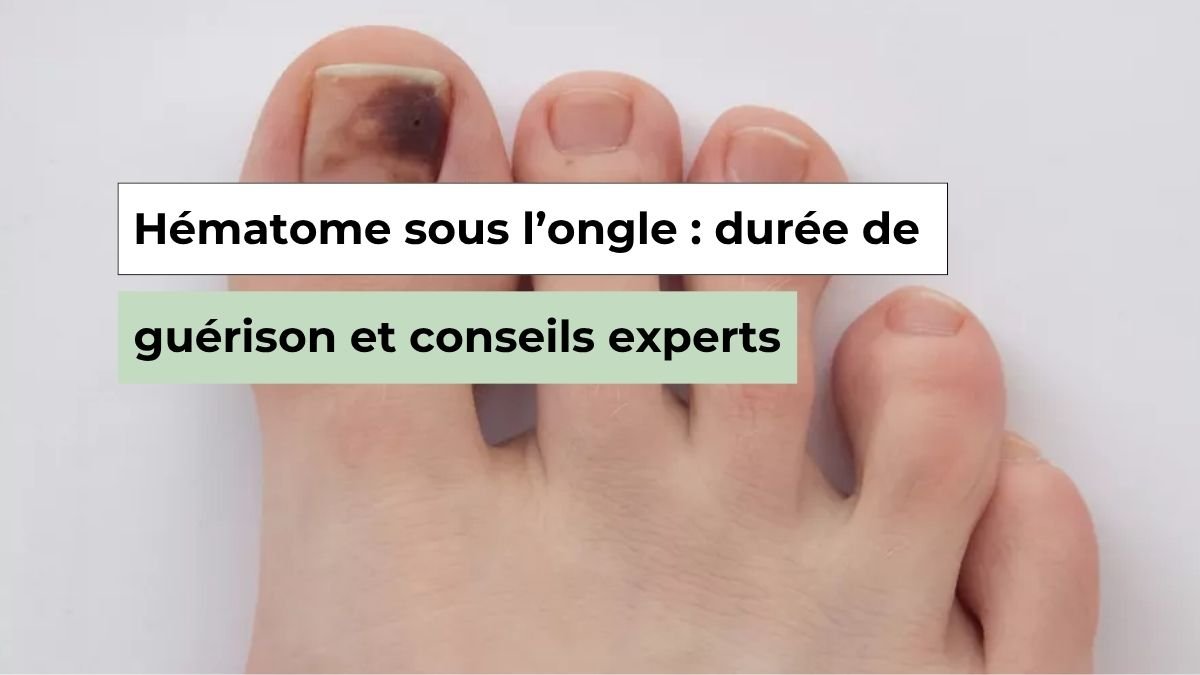 Hématome sous l’ongle durée de guérison et conseils experts Semello.fr — free download