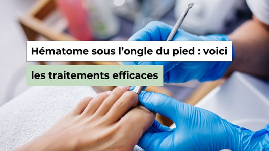 Hématome sous l’ongle du pied : symptômes, durée et solutions efficaces - Semello.fr