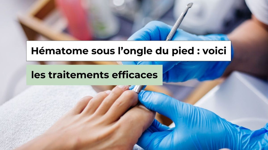 Hématome sous l’ongle du pied : causes et traitements efficaces