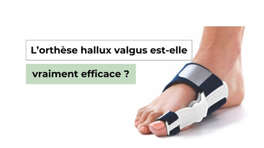 L’orthèse hallux valgus est-elle vraiment efficace ? - Semello.fr