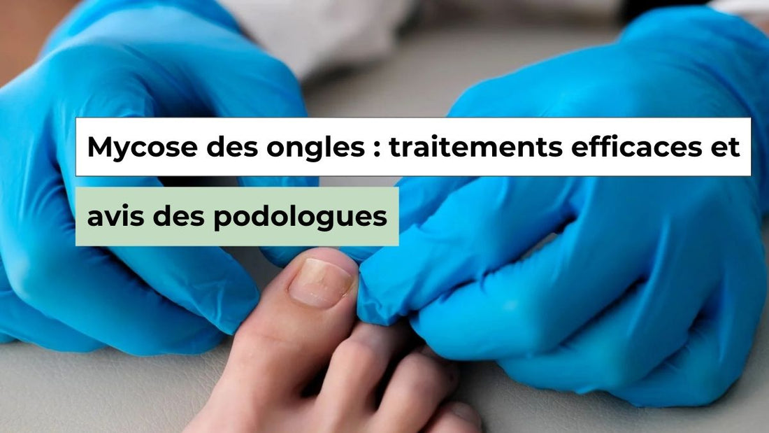 Mycose des ongles : quels traitements pour s’en débarrasser ? - Semello.fr