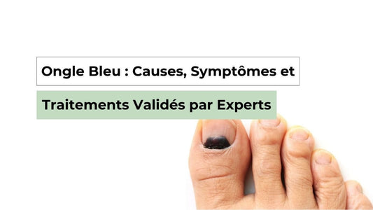 Ongle bleu : causes, signes et solutions fiables pour vos pieds - Semello.fr