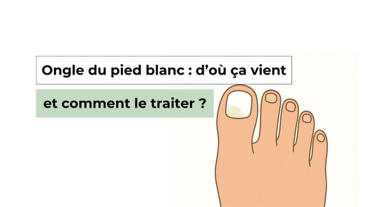 Ongle du pied blanc : d’où ça vient et comment le traiter ? - Semello.fr