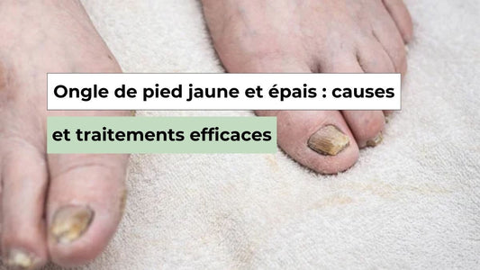Ongle du pied jaune et épais : pourquoi cela arrive et comment le traiter - Semello.fr
