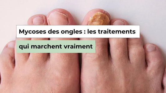 Onychomycose : pourquoi les traitements classiques échouent ? - Semello.fr