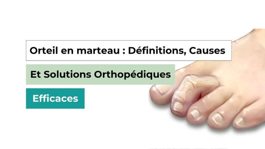 Orteil en marteau : Définitions, Causes et Solutions Orthopédiques Efficaces - Semello.fr