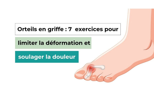 Orteils en griffe : 7  exercices pour limiter la déformation et soulager la douleur - Semello.fr