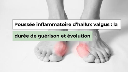 Poussée inflammatoire de l’hallux valgus : combien de temps dure-t-elle ? - Semello.fr