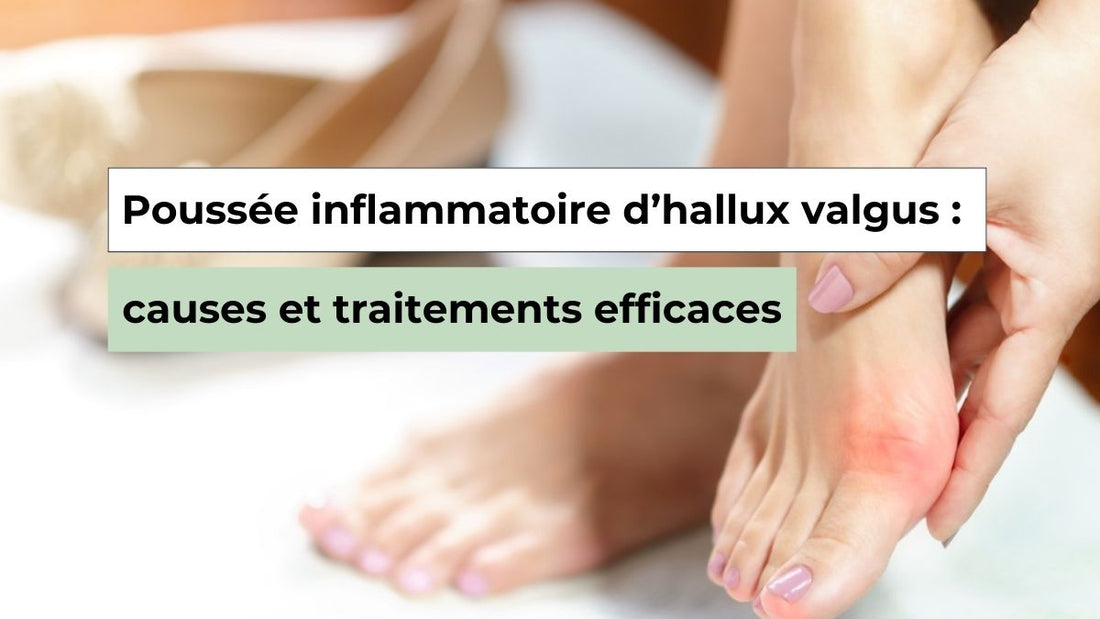 Poussée inflammatoire d’hallux valgus : comprendre et soulager la douleur - Semello.fr