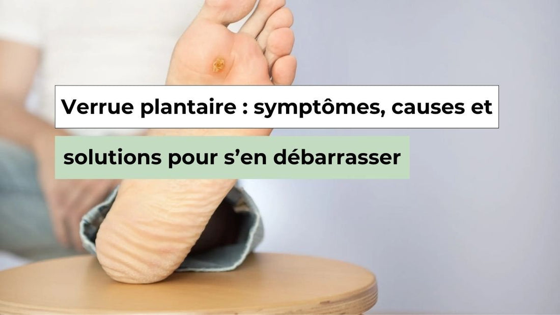 Verrue plantaire : symptômes, causes et solutions pour s’en débarrasser - Semello.fr