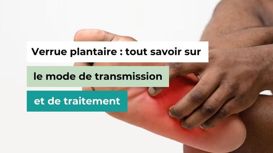 Verrue plantaire : tout savoir sur le mode de transmission et de traitement - Semello.fr