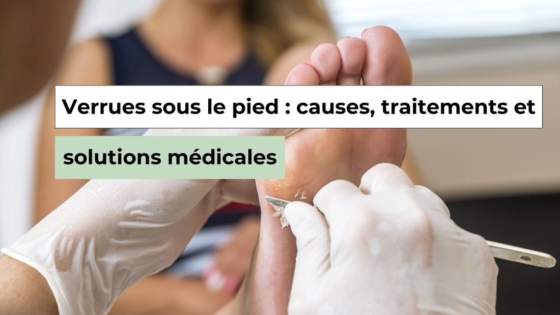Verrues sous le pied : reconnaître, traiter et soulager la douleur - Semello.fr