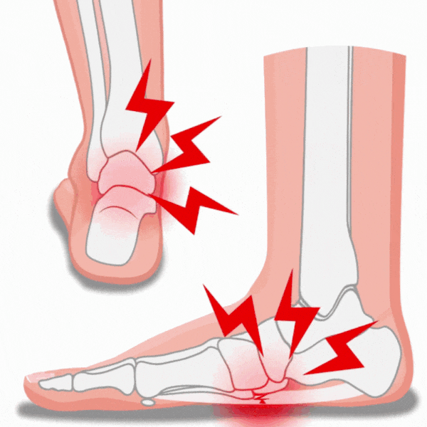 Semelles Orthopédique Douleur Plantaire
