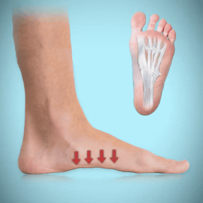 ConfortPlus™ - Semelles orthopédiques antidouleur