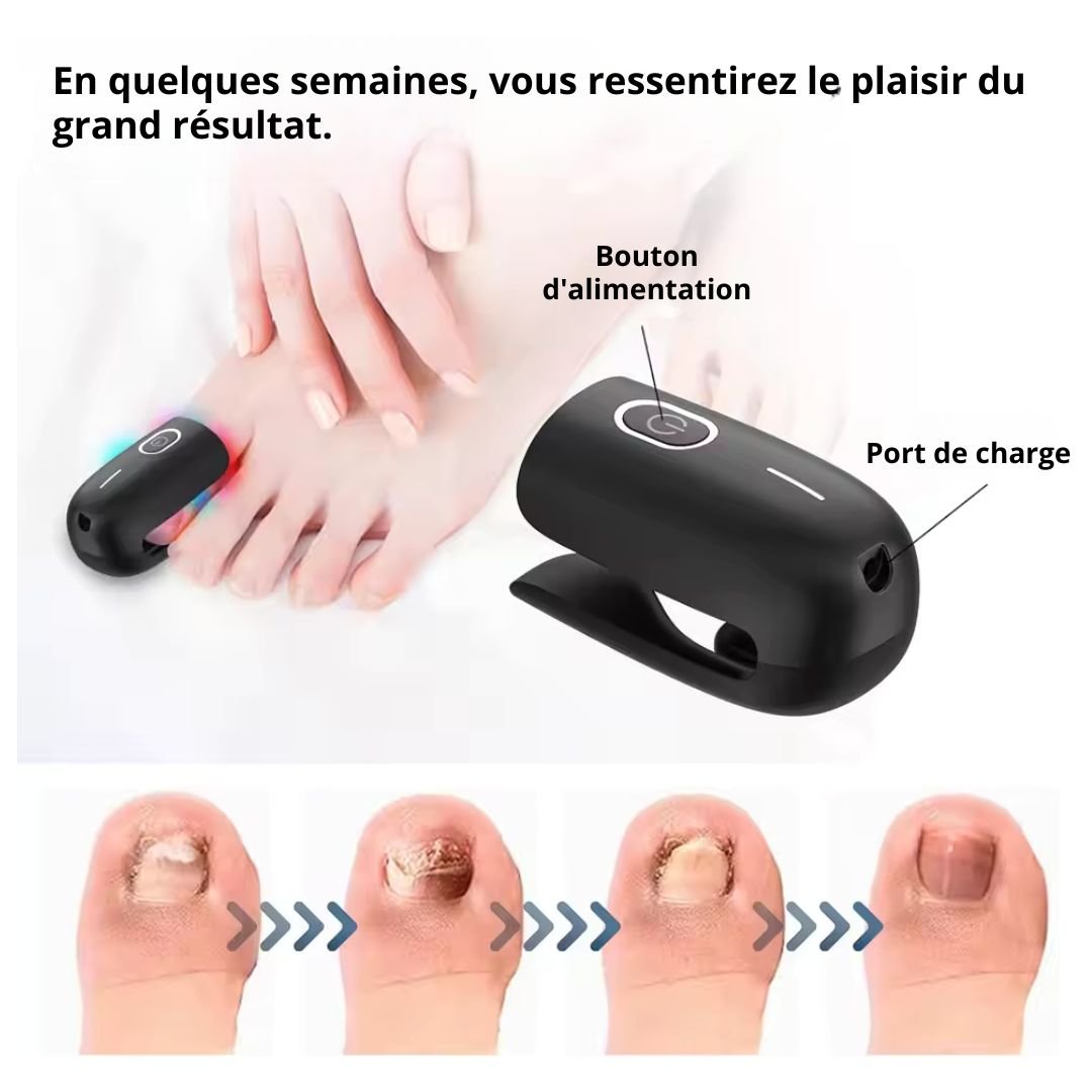 Appareil de traitement des Mycoses Rapide - Semello.fr