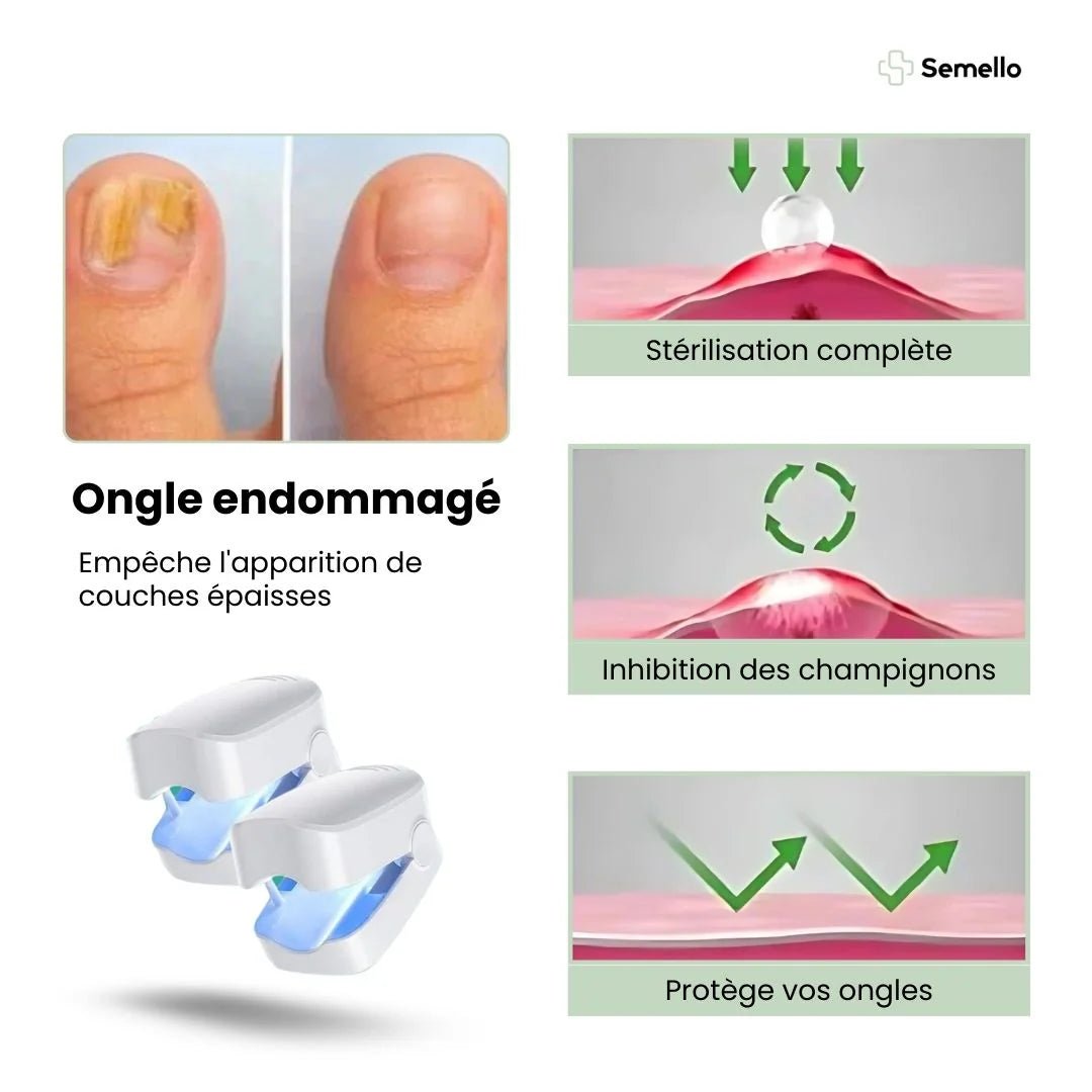 Appareil de Traitement UV des Mycoses - Semello.fr