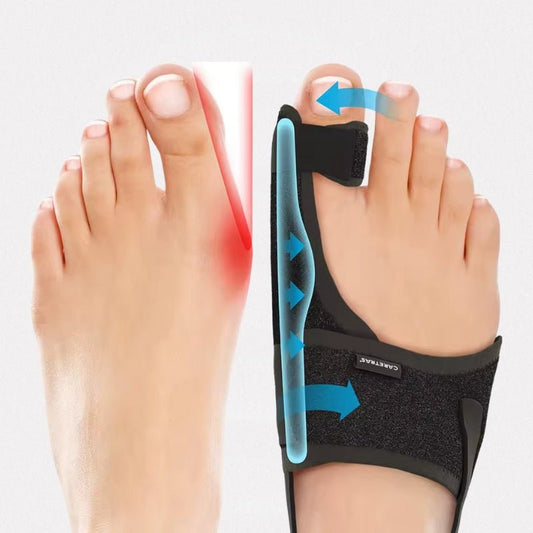 Attelle de nuit pour Hallux Valgus - Semello.fr