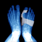 Attelle amovible de nuit pour Hallux Valgus