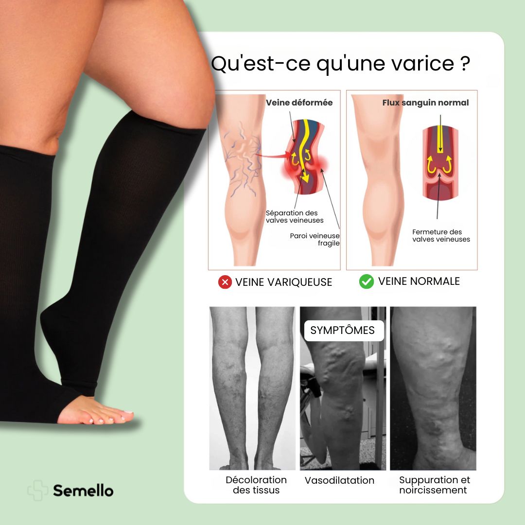 Chaussettes de contention respirante orteils libres (20 - 30 mmHg) - Semello.fr