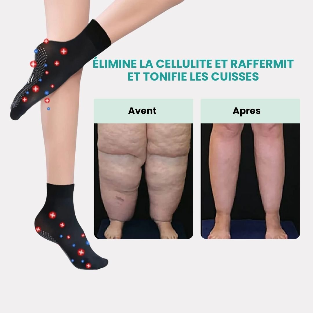 Chaussettes de Massage Minceur – Massage & Circulation - Semello.fr