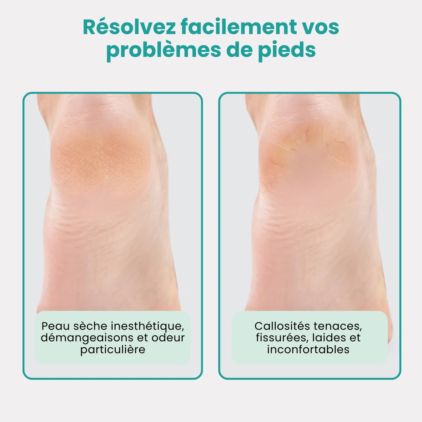 Râpe à Pieds Professionnelle – Élimine Callosités & Peaux Mortes - Semello.fr