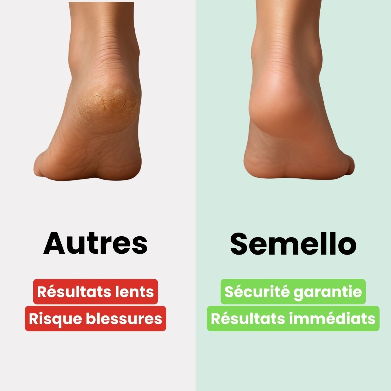 Râpe à Pieds Professionnelle – Élimine Callosités & Peaux Mortes - Semello.fr