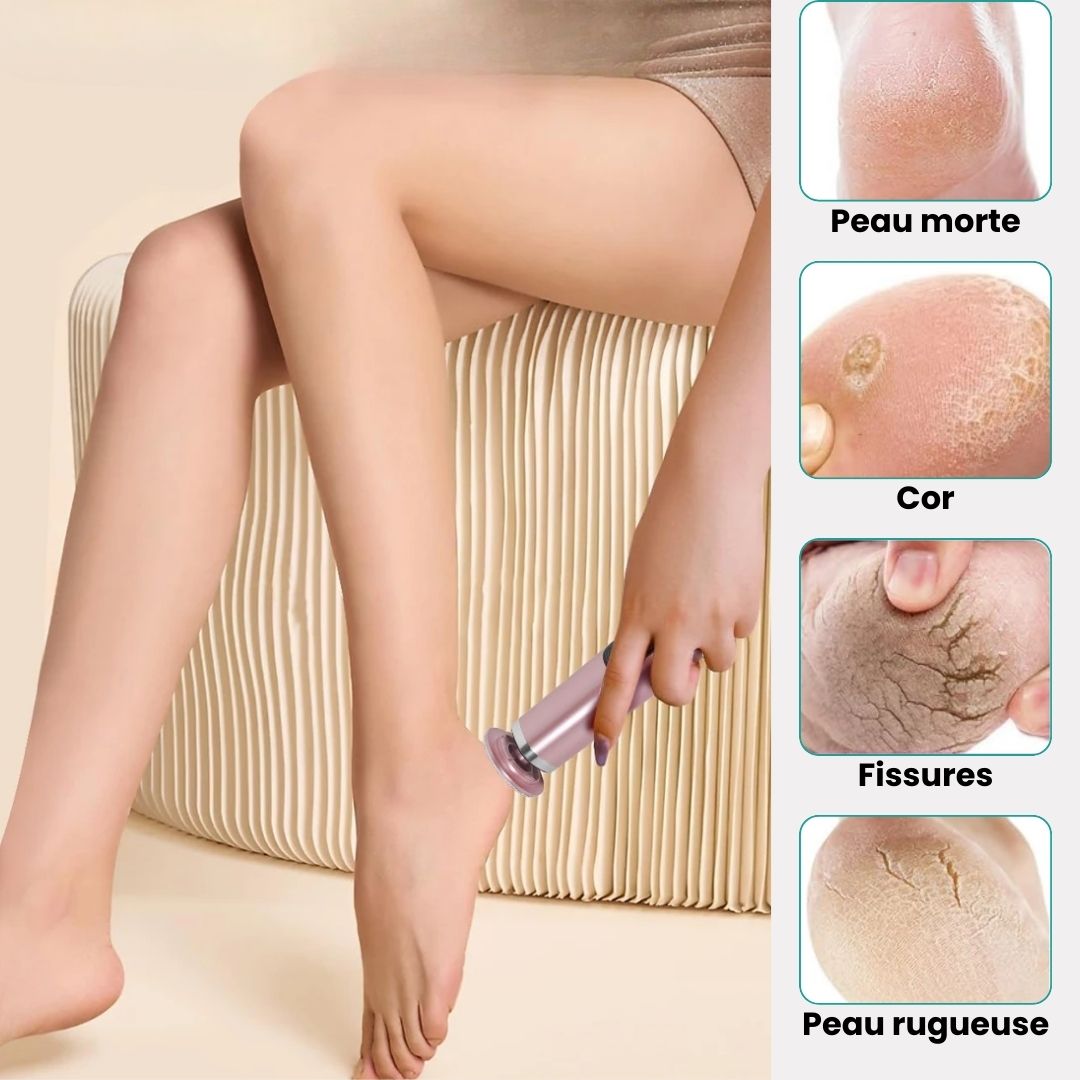 Râpe Anti - Cors Professionnelle | Pieds Doux & Sains - Semello.fr