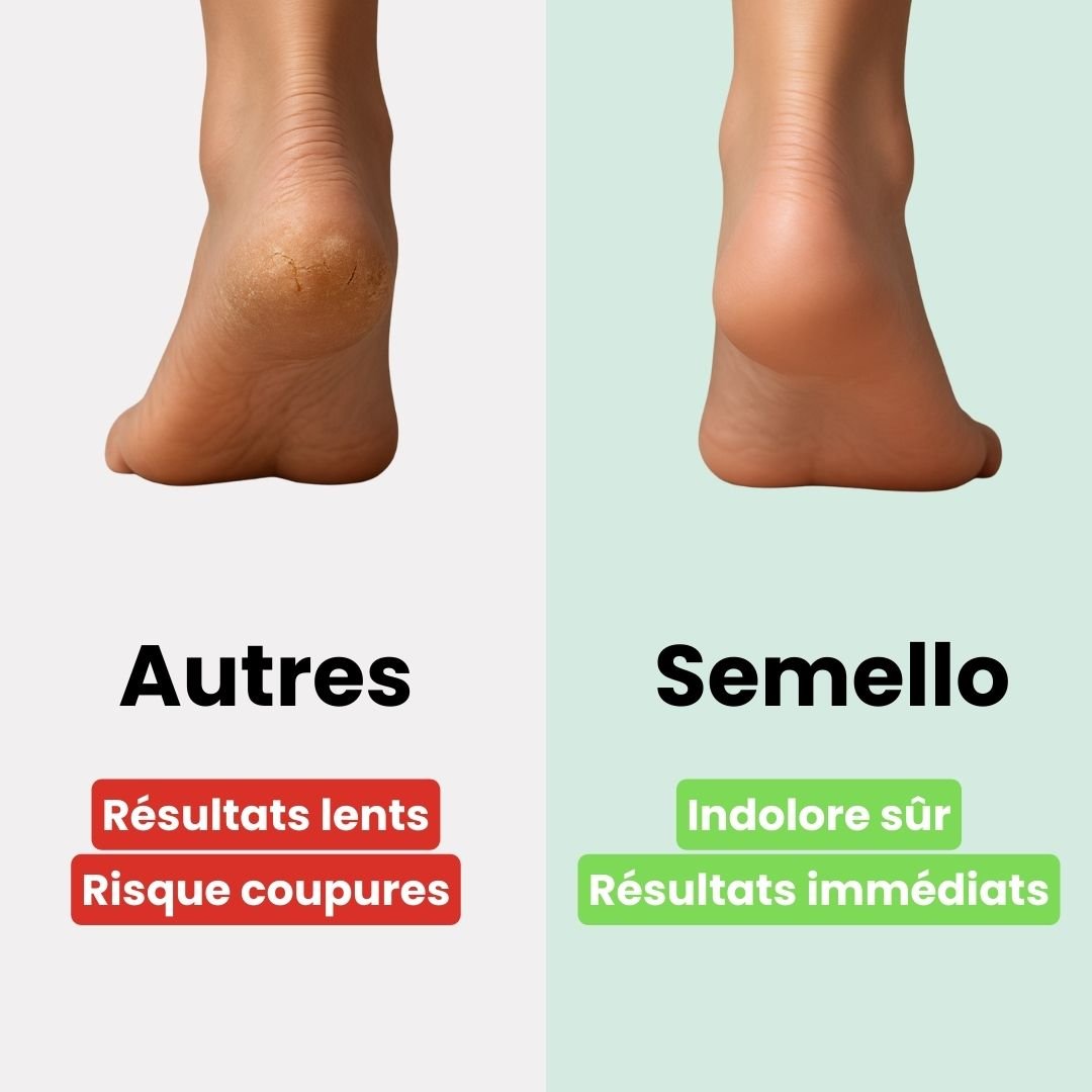 Râpe Électrique Anticalosités – Pieds Doux & Lisses - Semello.fr