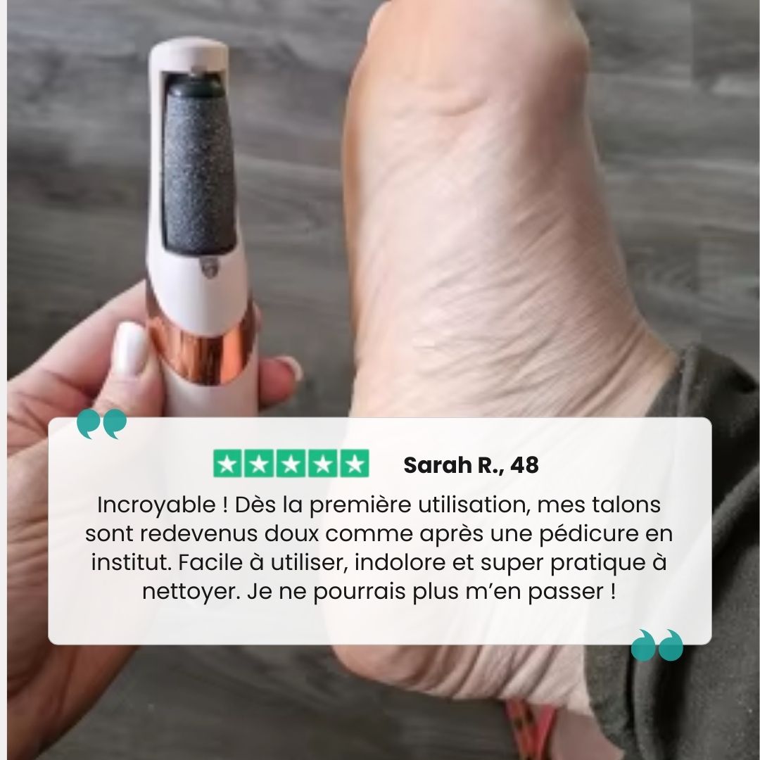 Râpe Électrique Anticalosités – Pieds Doux & Lisses - Semello.fr