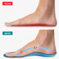 Semelles orthopédiques hallux valgus - Semello.fr