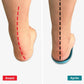 Semelles orthopédiques hallux valgus - Semello.fr